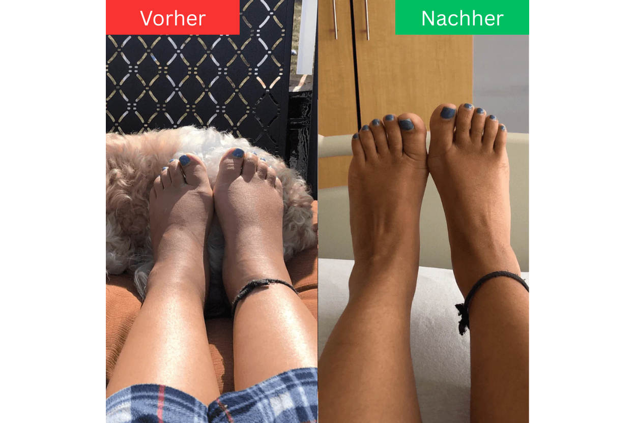 Gelenkherz® - Stepaura Pro