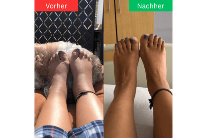 Gelenkherz® - Stepaura Pro